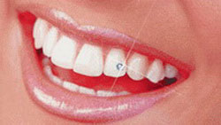 Hiding on teeth, Swarovski ornaments