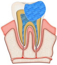 After treatment