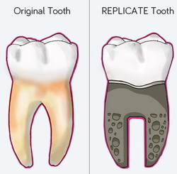 replicate Wroclaw implants