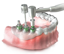 wroclaw surgical templates