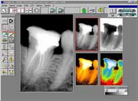 Digital es ray - Dog Pole, Zakrzéw