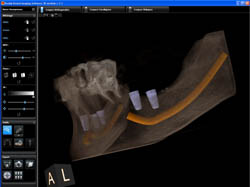 tomografia 3d kodak
