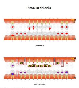 Plan leczenia stomatologicznego