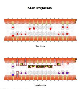 Plan leczenia stomatologicznego